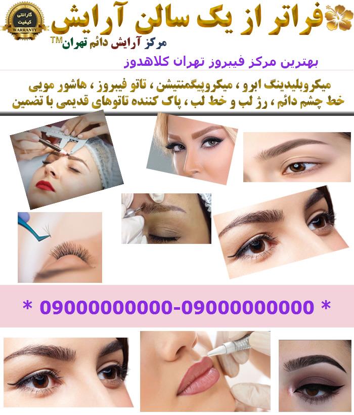 بهترین مرکز فیبروز تهران کلاهدوز