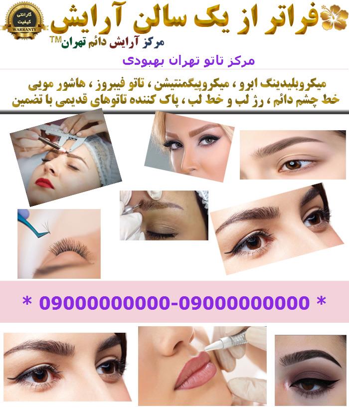 مرکز تاتو تهران بهبودی