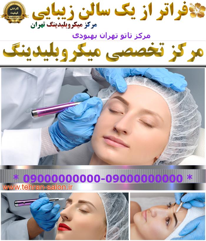 مرکز تاتو تهران بهبودی