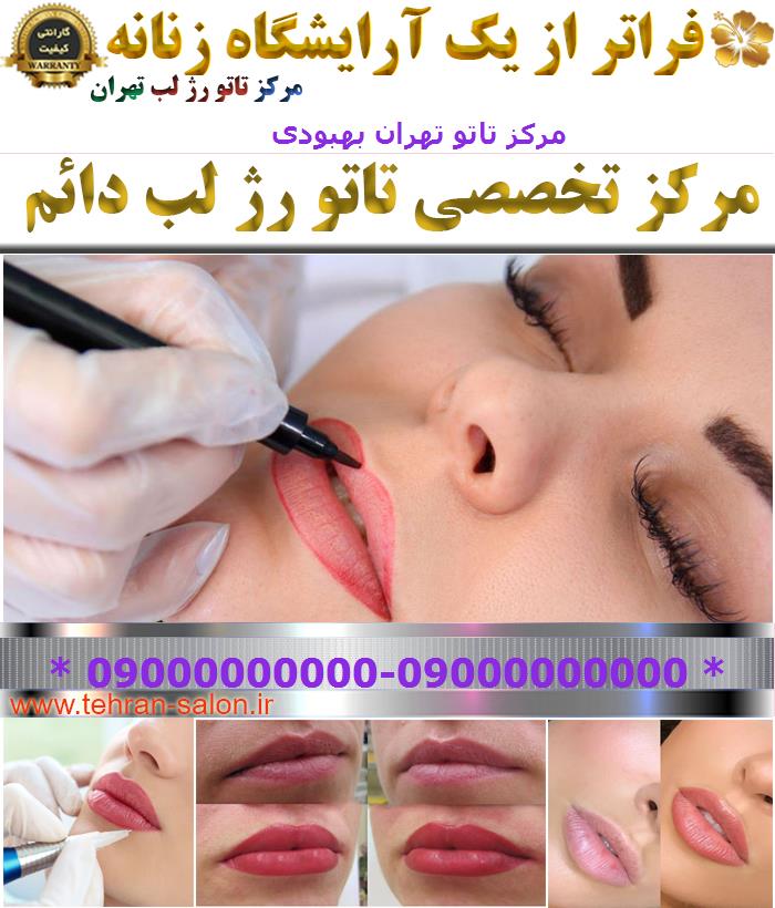 مرکز تاتو تهران بهبودی